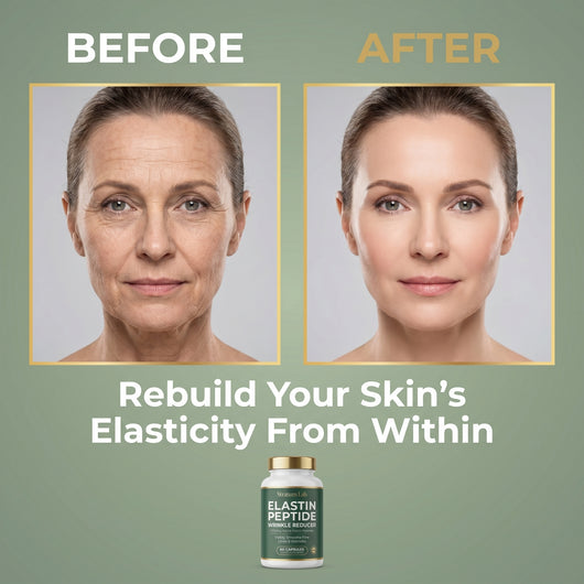Elastin Peptide Wrinkle Reducer Formula